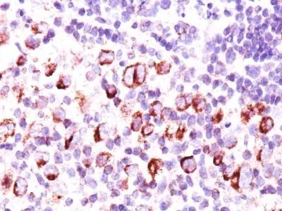 Anti-bcl-x(BX006 + 2H12), CF640R conjugate - image 1