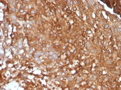 Anti-Beta-2 Microglobulin (B2M)(B2M/961) - image 2