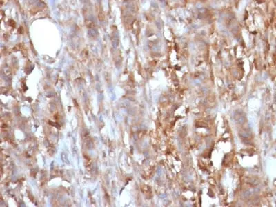 Anti-Beta-2 Microglobulin (B2M)(B2M/961) - image 6