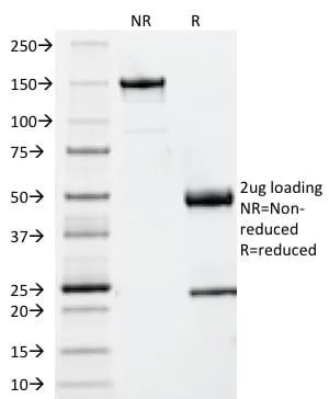 Anti-Beta-2 Microglobulin (B2M)(B2M/961) - image 10