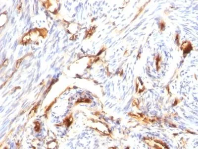 Anti-Beta-2-Microglobulin (B2M)(B2M/1118) - image 2