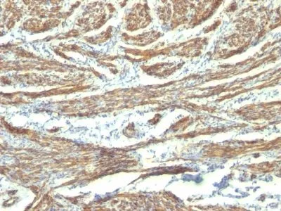 Anti-Caldesmon, HMW (h-Caldesmon)(CALD1/820 + h-CALD) - image 1
