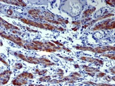 Anti-Caldesmon, HMW (h-Caldesmon)(h-CALD), CF640R conjugate - image 1