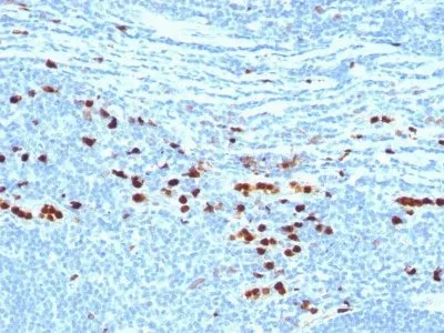 Anti-Calgranulin B / MRP-8/-14 / MAC 387 / S100A8/A9 / Macrophage Ag(MAC387), CF647 conjugate - image 1