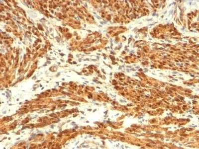 Anti-Calponin-1(CALP + CNN1/832) - image 2