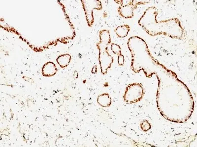 Anti-Calponin-1(CALP + CNN1/832) - image 3
