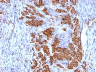 Anti-Calponin-1(CALP + CNN1/832), CF640R conjugate - image 1