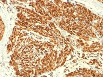 Anti-Calponin-1(CALP), CF405S conjugate - image 1