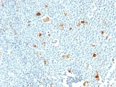 Anti-Calprotectin (MRP14)(S100A9)(CPT/1028) - image 1