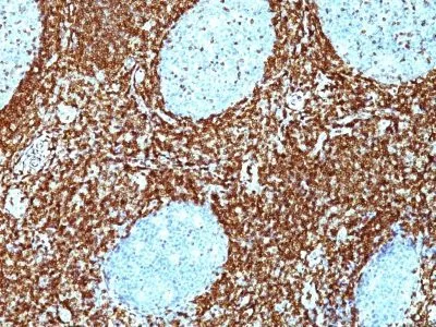 Anti-bcl-2(BCL2/782 + BCL2/796), CF740 conjugate - image 1