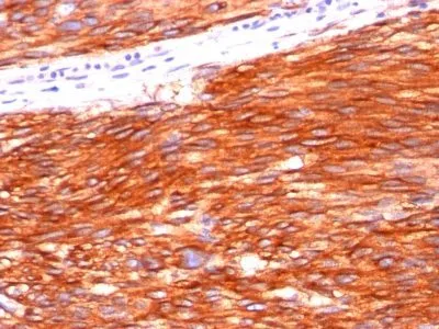 Anti-CD117(C117/370), CF640R conjugate - image 1