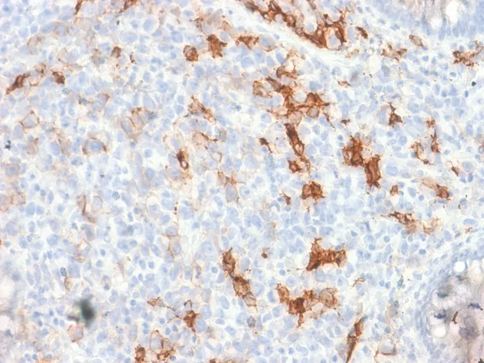Anti-NGF-Receptor (p75) / CD271 (Soft Tissue Tumor Marker) (NGFR/1997R), CF740 conjugate - image 1