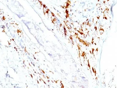 Anti-CD1a(O10 + C1A/711), CF640R conjugate - image 1