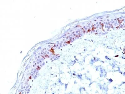 Anti-CD1a(O10), CF640R conjugate - image 1