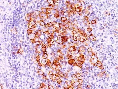 Anti-CD30(CD30/412) - image 2