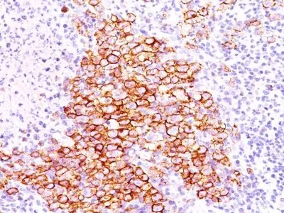 Anti-CD30(CD30/412) - image 1