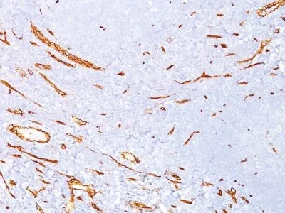 Anti-CD34(QBEnd/10) - image 1