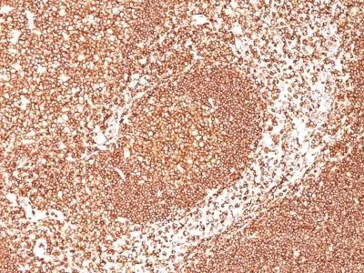 Anti-CD45 / LCA(2B11 + PD7/26), CF568 conjugate - image 1