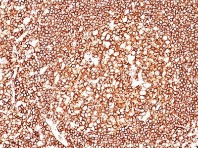 Anti-CD45 / LCA(2B11) - image 2