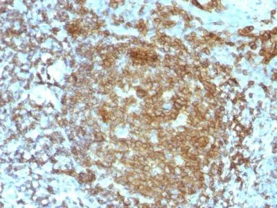 Anti-CD45RA(PTPRC/818) - image 1