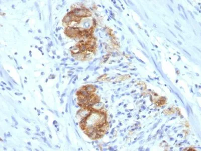 Anti-CD56 / NCAM(123C3.D5), Biotin conjugate - image 1