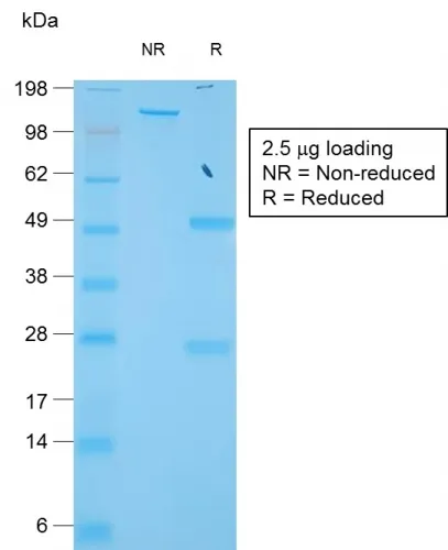 Anti-TIMP1 (Colorectal and Lymph Node Metastasis Marker)(TIMP1/1944R), CF740 conjugate - image 1