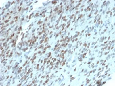 Anti-TLE1 (Synovial Sarcoma Marker) (TLE1/2062), CF740 conjugate - image 2