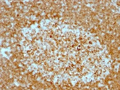 Anti-CD74(LN-2 + CLIP/813), Biotin conjugate - image 1