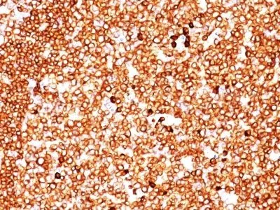 Anti-CD79a(JCB117 + HM47/A9), CF640R conjugate - image 2