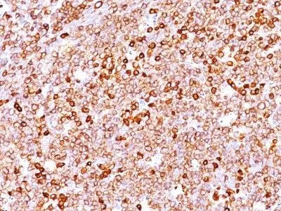 Anti-CD79a(JCB117 + HM47/A9), CF640R conjugate - image 1