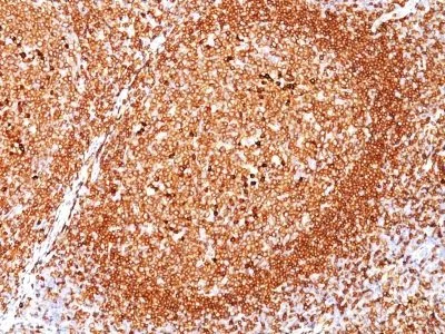 Anti-CD79a(JCB117), CF640R conjugate - image 1