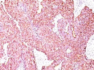 Anti-Chromogranin A(CGA/414) - image 2