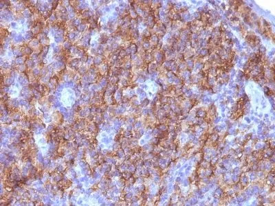 Anti-Chromogranin A(CGA414 + CGA/777 + CGA/798), CF594 conjugate - image 3