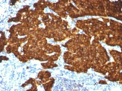 Anti-Chromogranin A(CGA414 + CGA/777 + CGA/798), CF594 conjugate - image 1