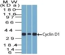 Anti-Cyclin D1(DCS-6) - image 3
