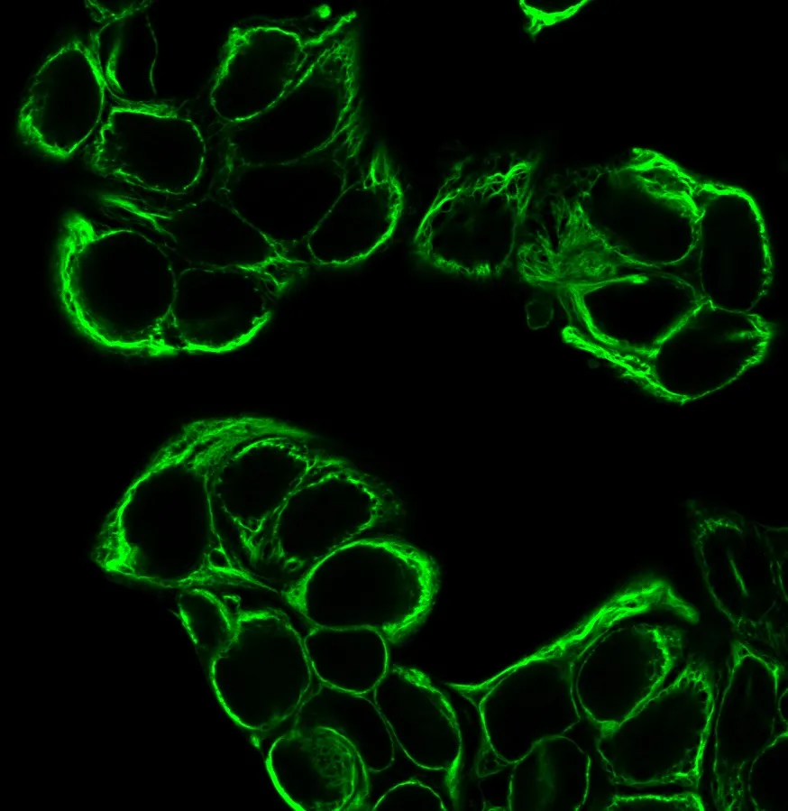 Anti-Cytokeratin 18(KRT18/834) - image 2