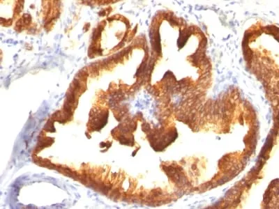 Anti-Cytokeratin 18(KRT18/836), CF640R conjugate - image 1