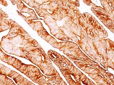 Anti-Cytokeratin 5/8(C-50), Biotin conjugate - image 1