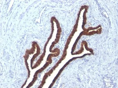 Anti-Cytokeratin 7(KRT7/760 + KRT7/903) - image 1