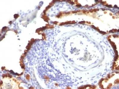 Anti-Cytokeratin 7(KRT7/760 + KRT7/903) - image 2