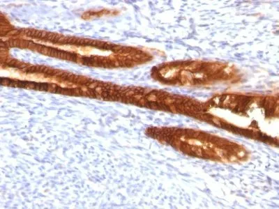 Anti-Cytokeratin 7(KRT7/760 + KRT7/903) - image 3