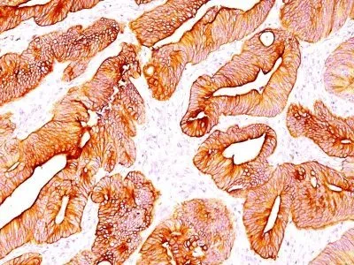 Anti-Cytokeratin, multi(C11) - image 2