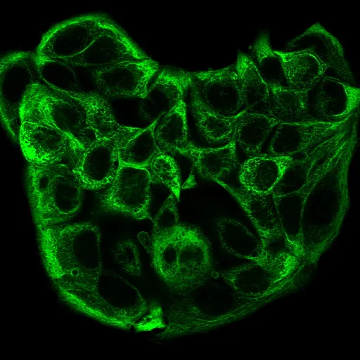 Anti-Cytokeratin, multi(C11) - image 1