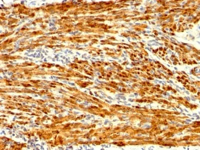 Anti-Calponin-1 (Smooth Muscle Marker) (CNN1/1408R), CF740 conjugate - image 1