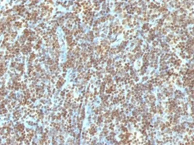 Anti-Double Stranded DNA (dsDNA)(121-3) - image 2