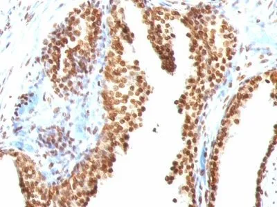 Anti-Double Stranded DNA (dsDNA)(AE-2) - image 2