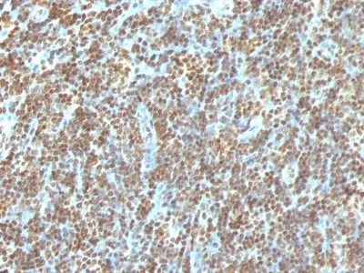 Anti-Double Stranded DNA (dsDNA)(AE-2), CF594 conjugate - image 1