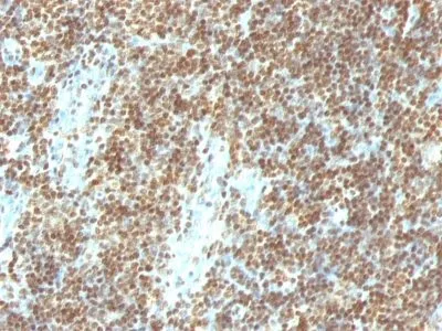 Anti-Double Stranded DNA (dsDNA)(DSD/958) - image 2