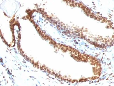 Anti-Double Stranded DNA (dsDNA)(DSD/958) - image 1