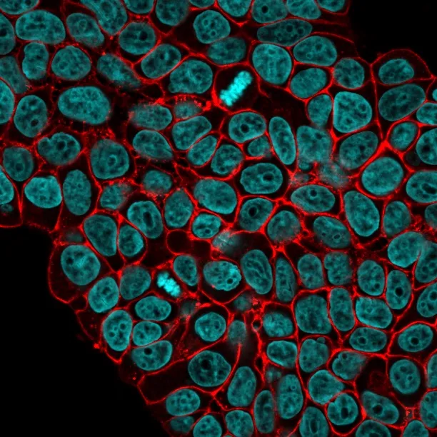 Anti-Ep-CAM / CD326(VU-1D9), CF640R conjugate - image 1